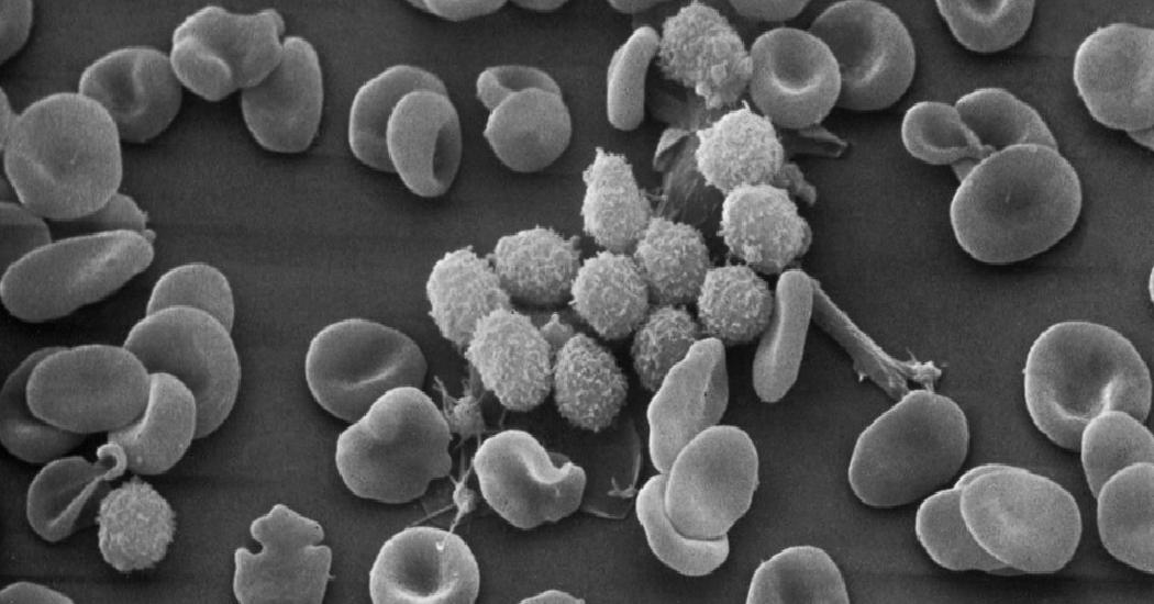 A Cancer Treatment Makes Leukemia Vanish, but Creates More Mysteries