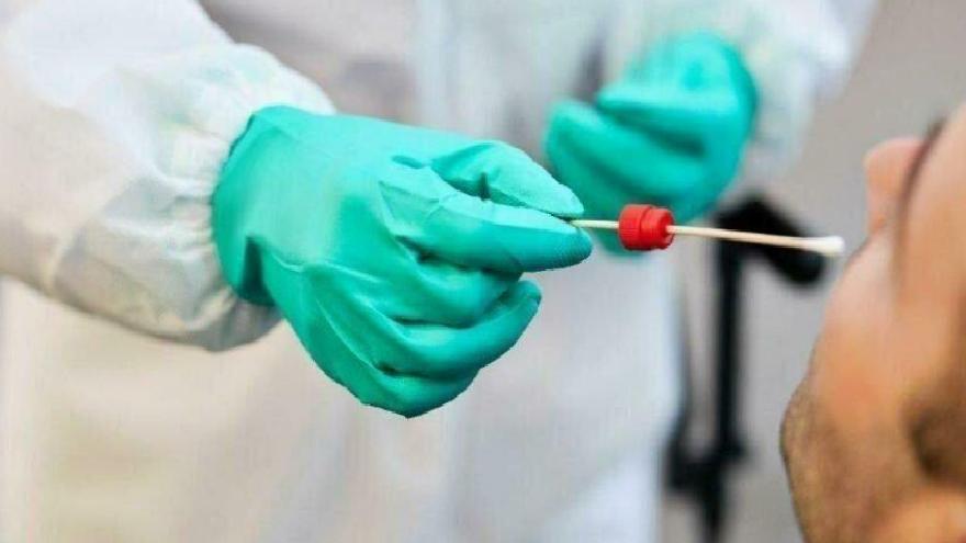 PCR test sonucu ne zaman çıkar? PCR testi ücretli mi?