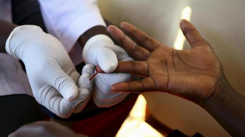 Yeni bir HIV/AIDS mutasyonu keşfedildi: Avrupa’da yayılıyor